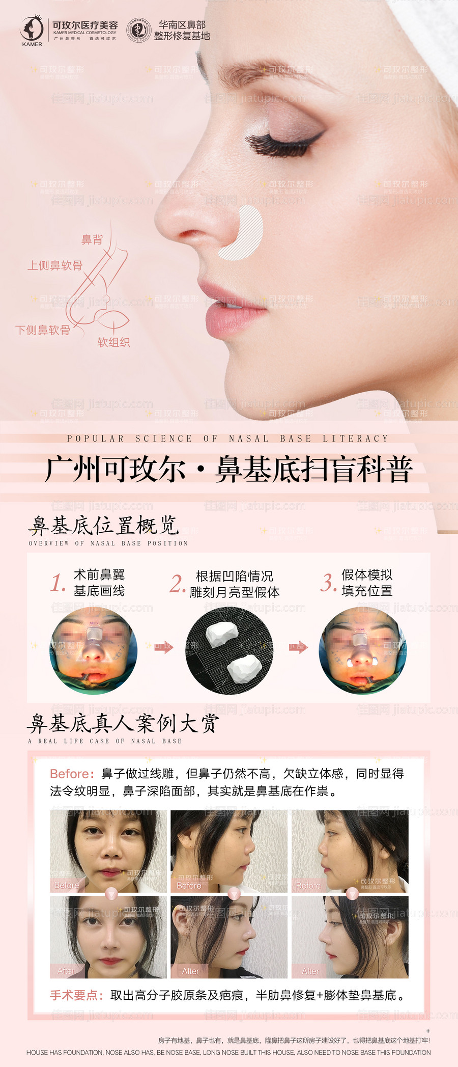 医美整形案例-源文件
