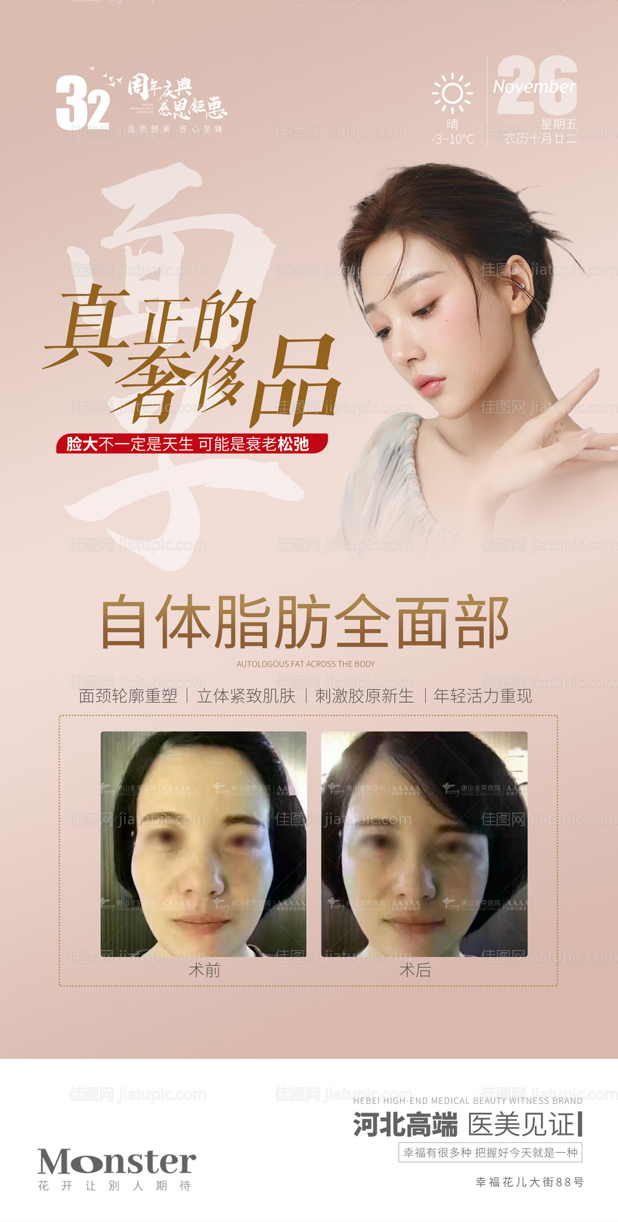 医美自体脂肪填充全面部-源文件