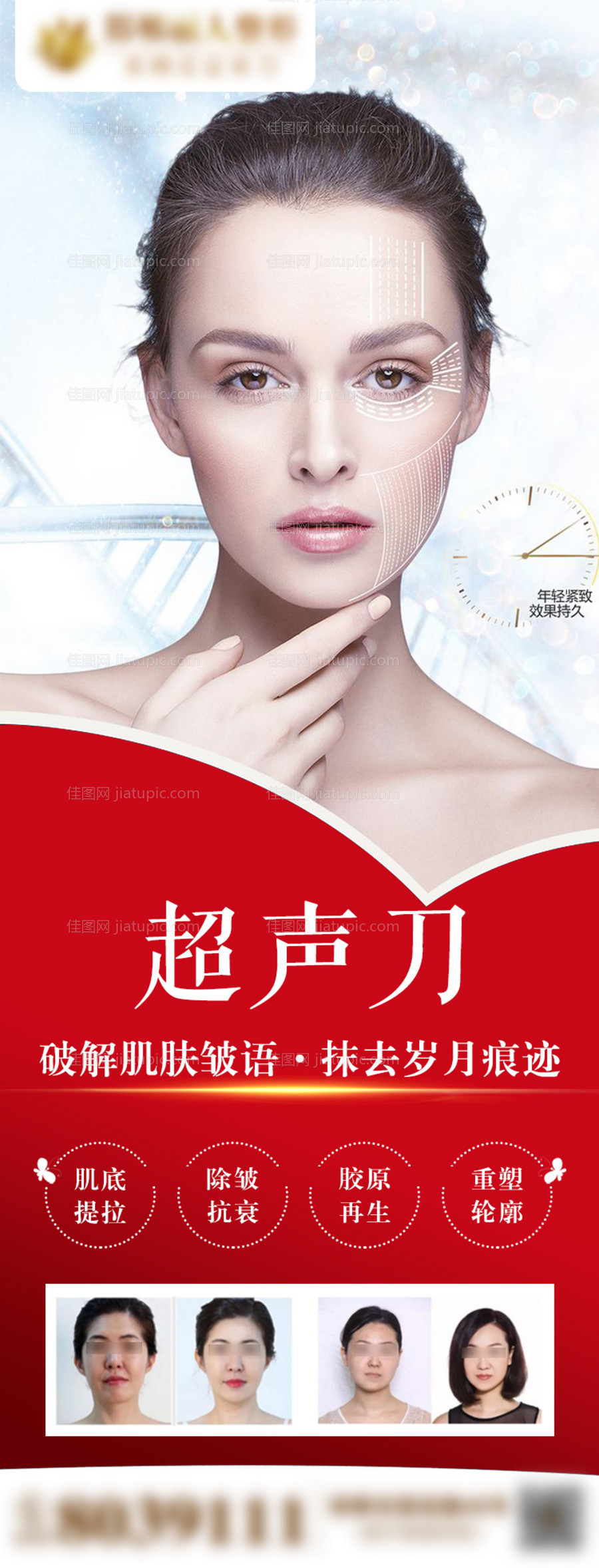 医美整形抗衰超声刀宣传展架-源文件