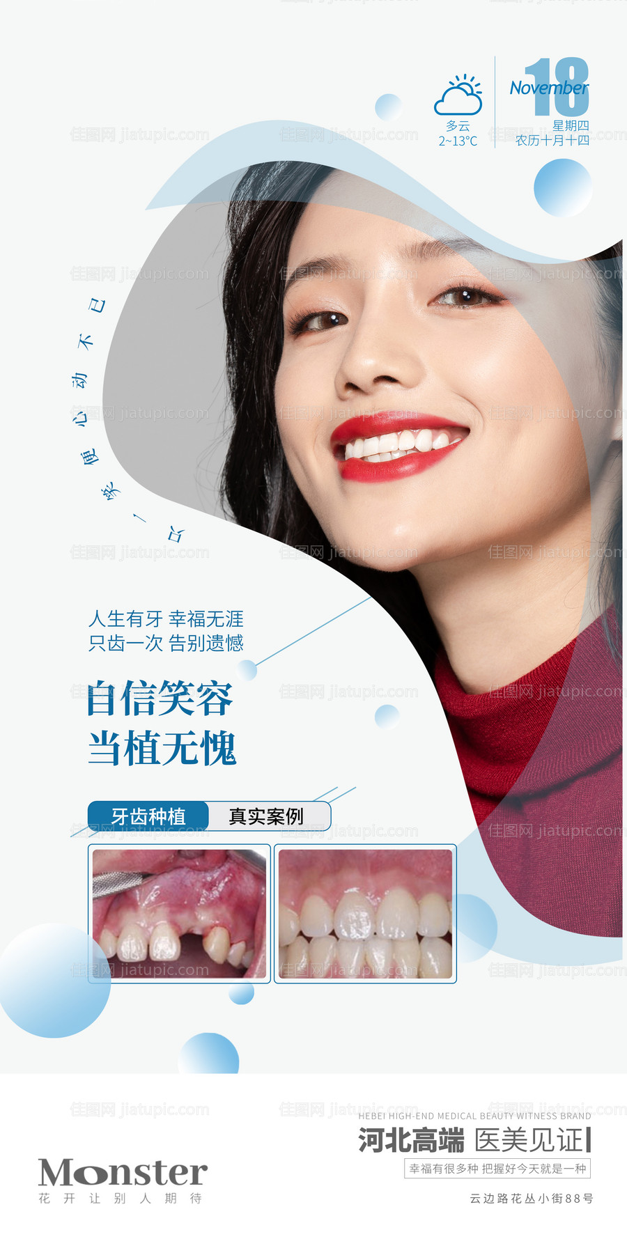 医美牙齿种植海报-源文件